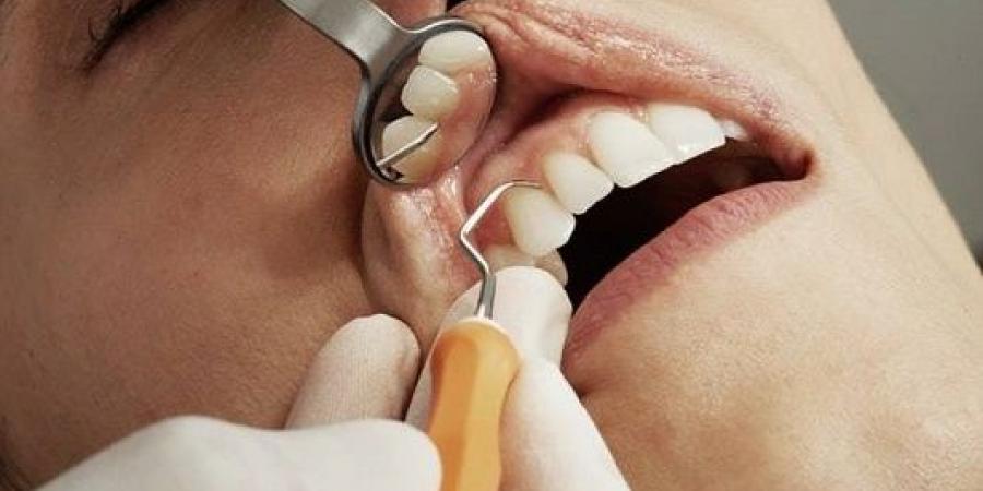 طبيب: الإهمال في صحة الأسنان يسبب أمراض القلب والجهاز الهضمي - نايل 360