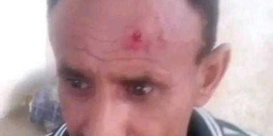 مسؤول حوثي يضرب أحد جنود الأمن بطريقة مُهينة (أسماء) - نايل 360